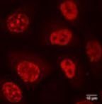 Cell cycle chromobodies®